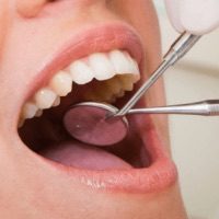 clínica-dental-tetuán-chequeo-dientes-espejos