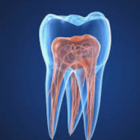 endodoncia-madrid-nervio